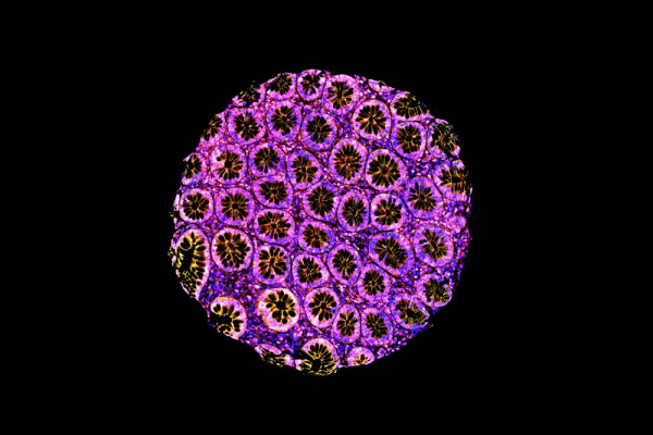 Leaders in cancer research