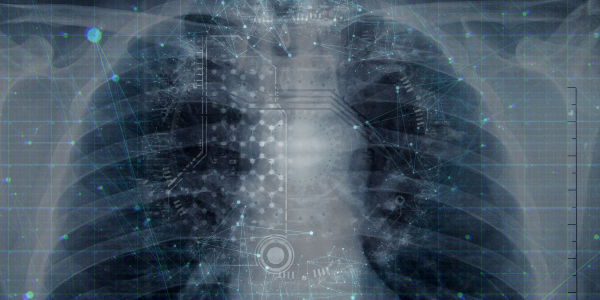 The AI ‘nudge’ taking aim at pulmonary embolism