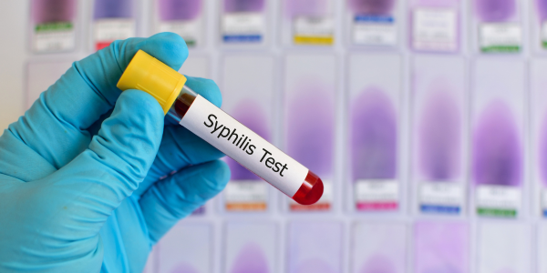 Queen’s researchers bring new data approach to syphilis response in Kingston