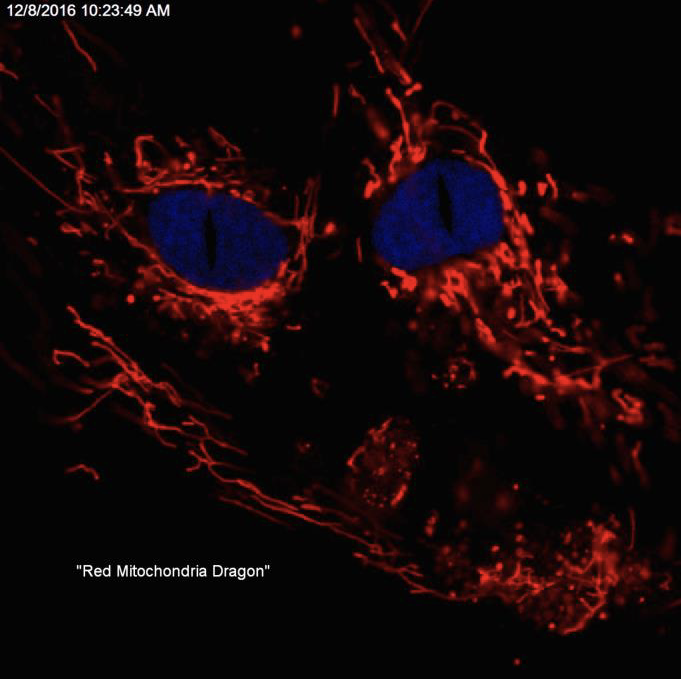 Research image of mitochondria that look like a dragon
