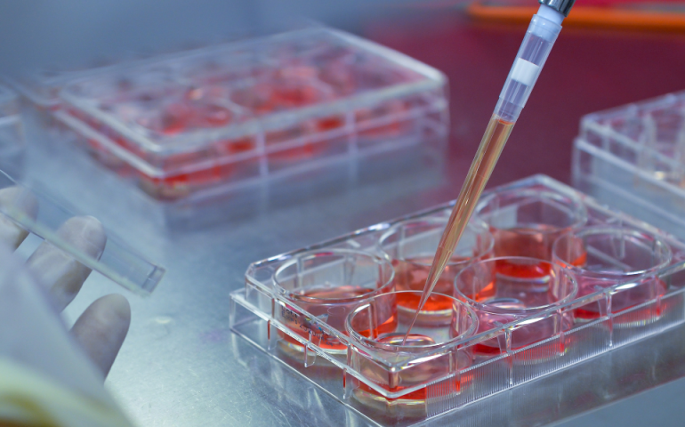 close up of a lab space where someone is using a pipette to deposit material into small containers