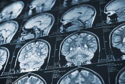 Predicting cancer spread with natural language processing