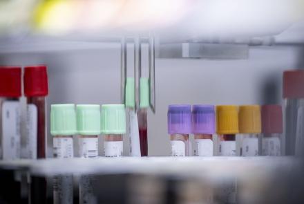 A common-sense approach to bloodwork