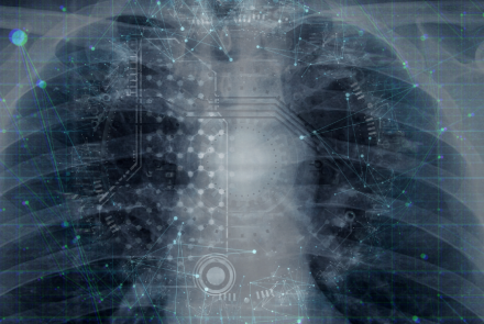 The AI ‘nudge’ taking aim at pulmonary embolism