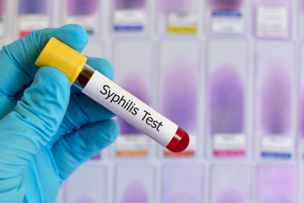 gloved hand holding a test tube of red liquid with a label that says Syphilis Test
