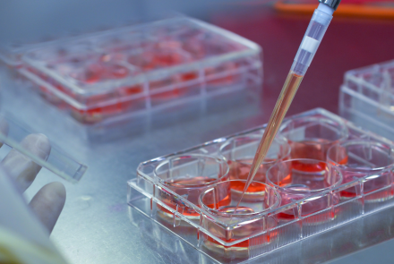 close up of a lab space where someone is using a pipette to deposit material into small containers